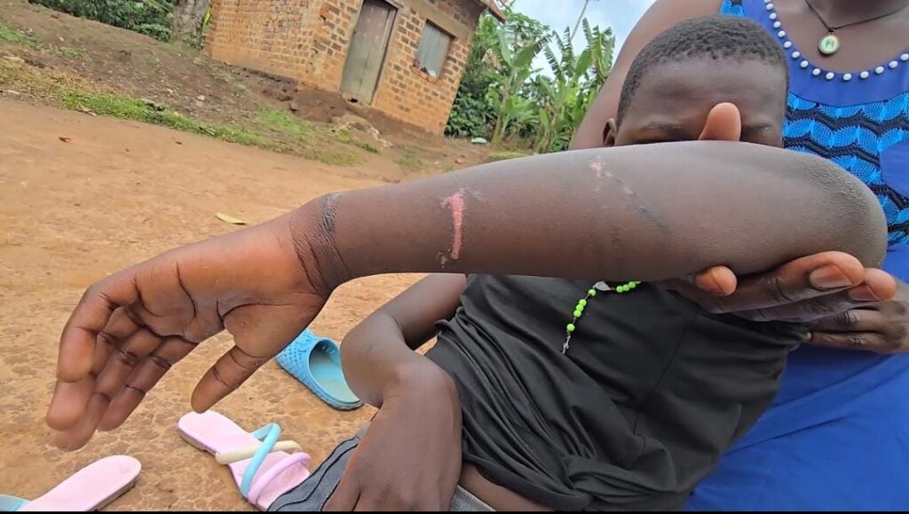 Teacher Arrested For Aggravated Corporal Punishment